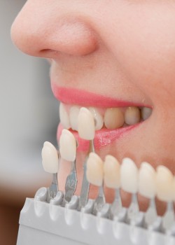 Estética Dental y Diseño de Sonrisa: Carillas y Aclaramiento Dental
