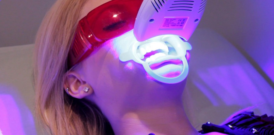 Blanqueamiento Dental