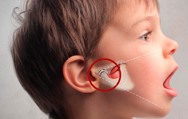 Articulación Temporo Mandibular