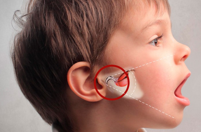 Articulación Temporo Mandibular