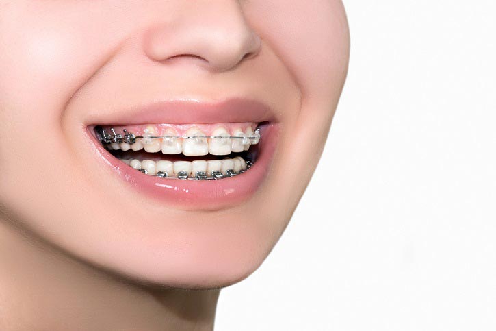 Estética, salud y ortodoncia