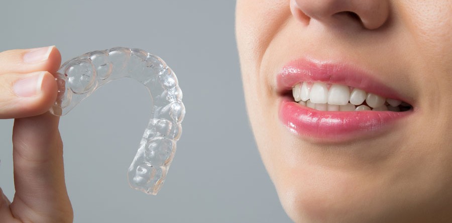 ¿Puedes llevar Invisalign? ¿Qué condiciones son necesarias para utilizar Invisalign?