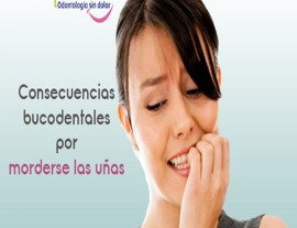 Consecuencias bucodentales por morderse las uñas