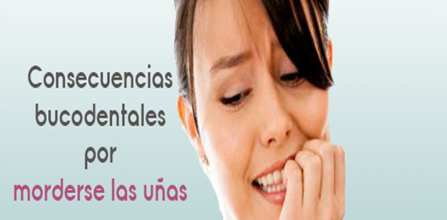 Consecuencias bucodentales por morderse las uñas